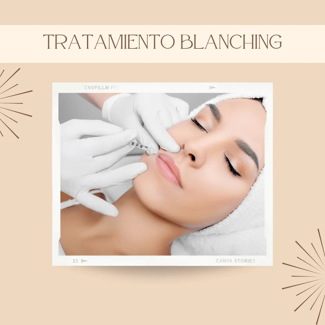 Tratamiento blanching