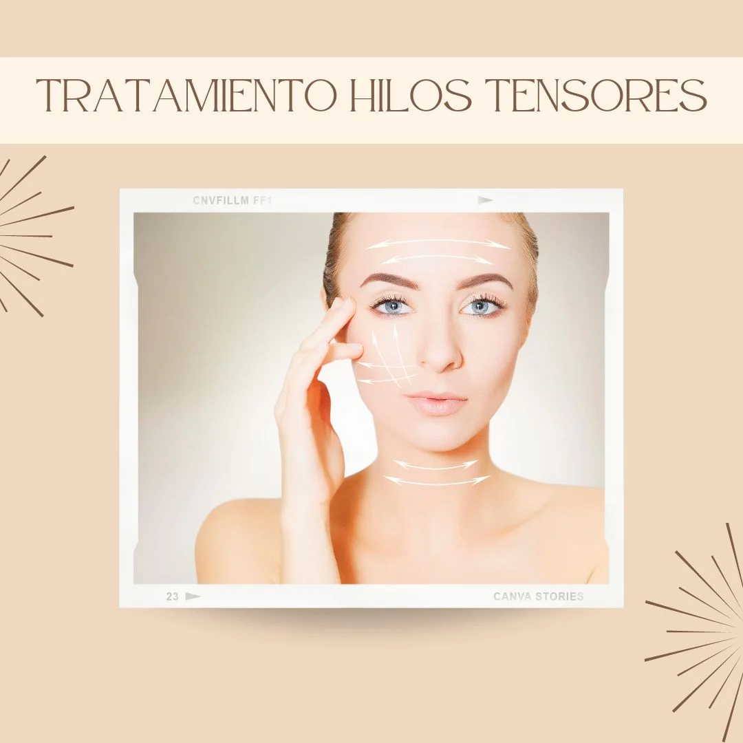 Tratamiento hilos tensores