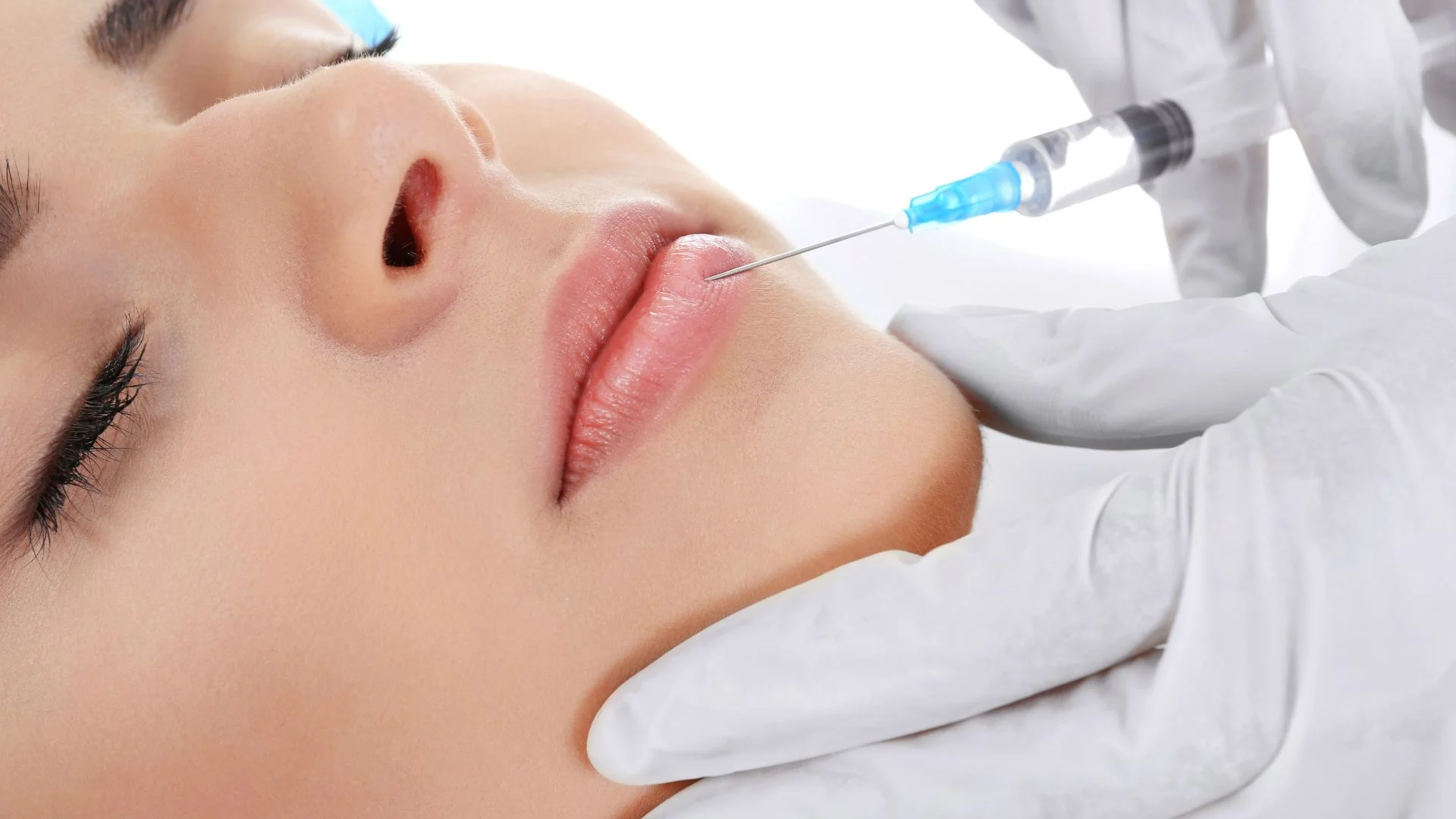 Tratamiento de medicina estetica - Relleno y aumento de labios y pómulos