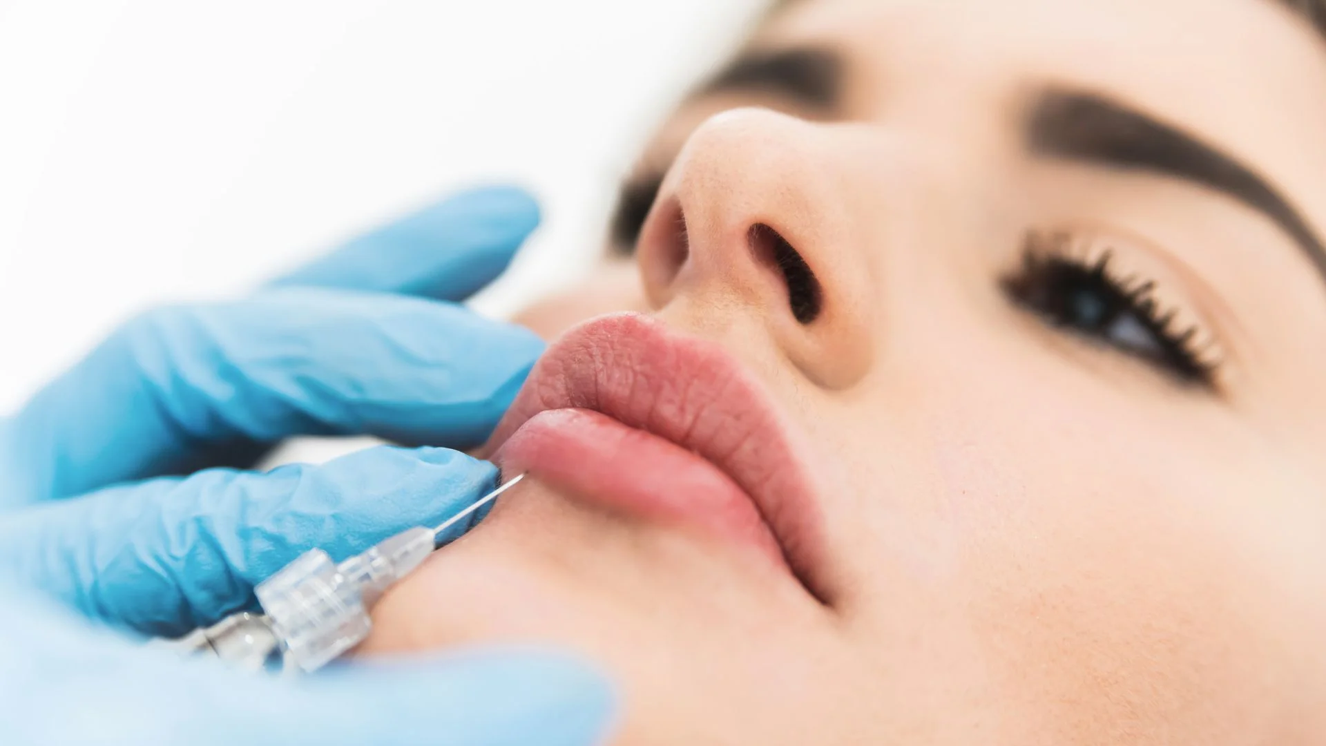 Tratamiento de medicina estetica - Tratamiento de labios